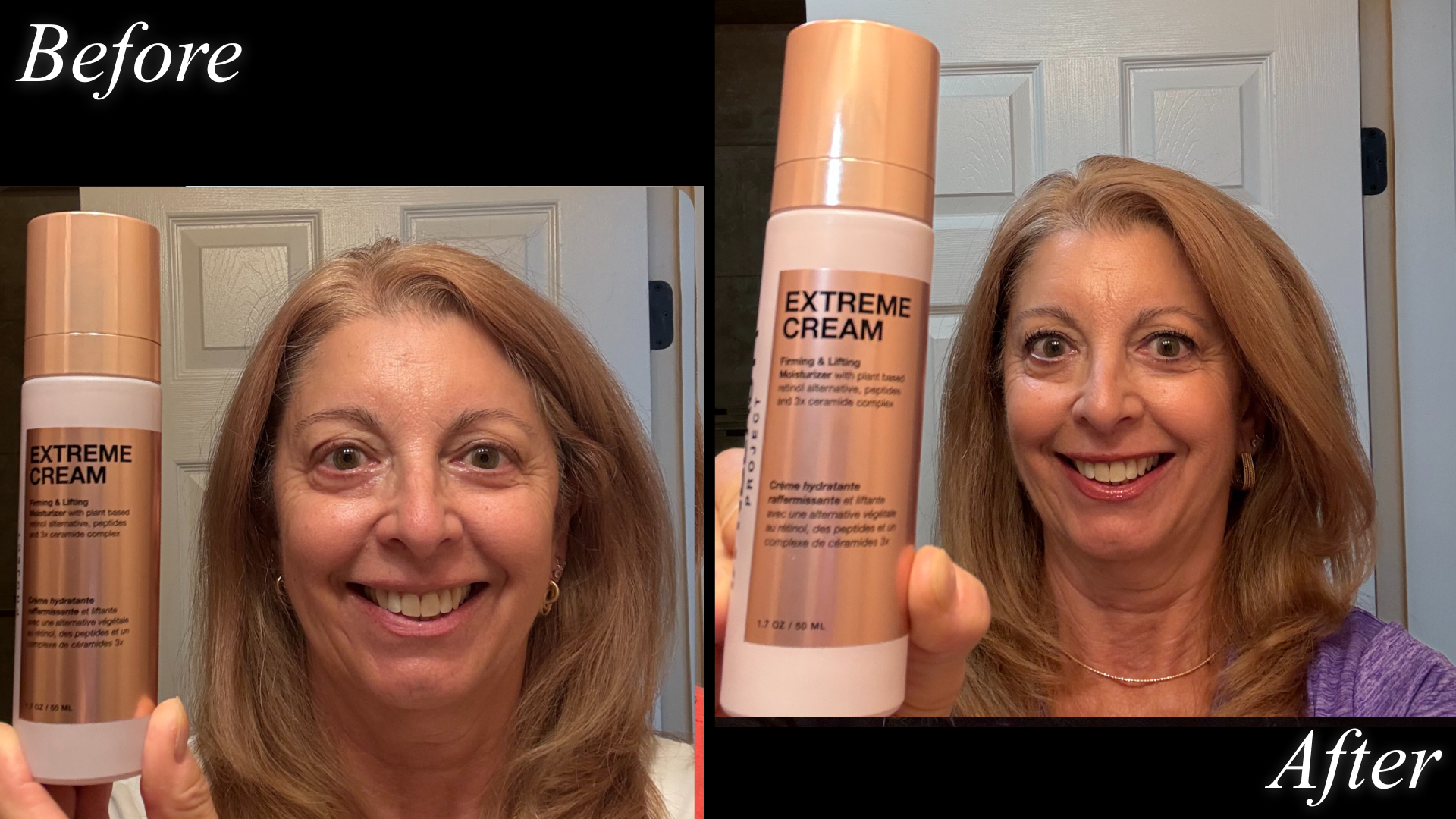 Jane Petrarca before and after using INNBEAUTY Project Extreme Cream Anti-Aging, Firming, & Lifting Refillable Moisturizer to tackle fine lines, wrinkles, and dryness.