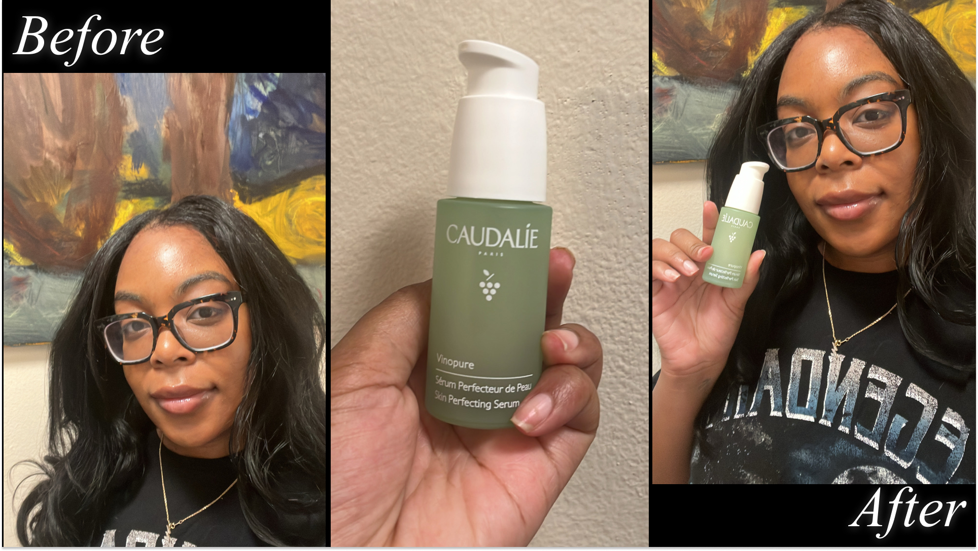 Ariel Baker testing Caudalie Natural Salicylic Acid Pore Minimizing Serum