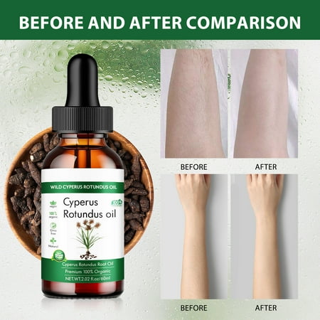 Cyperus Rotundus Oil, Cyprus Oil Natural Nut Grass Oil for Reducing Body Hair Growth, Smooth Skin and Hair Removal, Moisturizing &amp;amp; Soothing, Ideal for All Skin Types(3pcs)