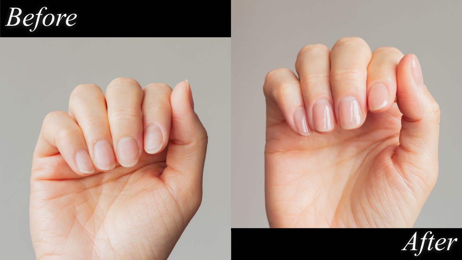 close up before and after treatment of hands