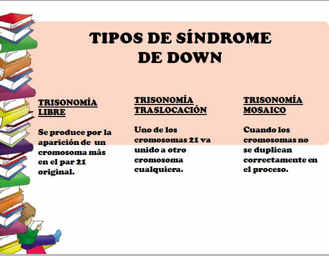 caracteristicas del sindrome de down