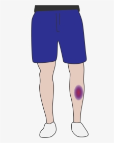 Bruise PNG Images, Free Transparent Bruise Download.