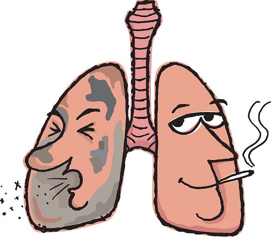 Smoking clipart tobacco effect, Smoking tobacco effect.