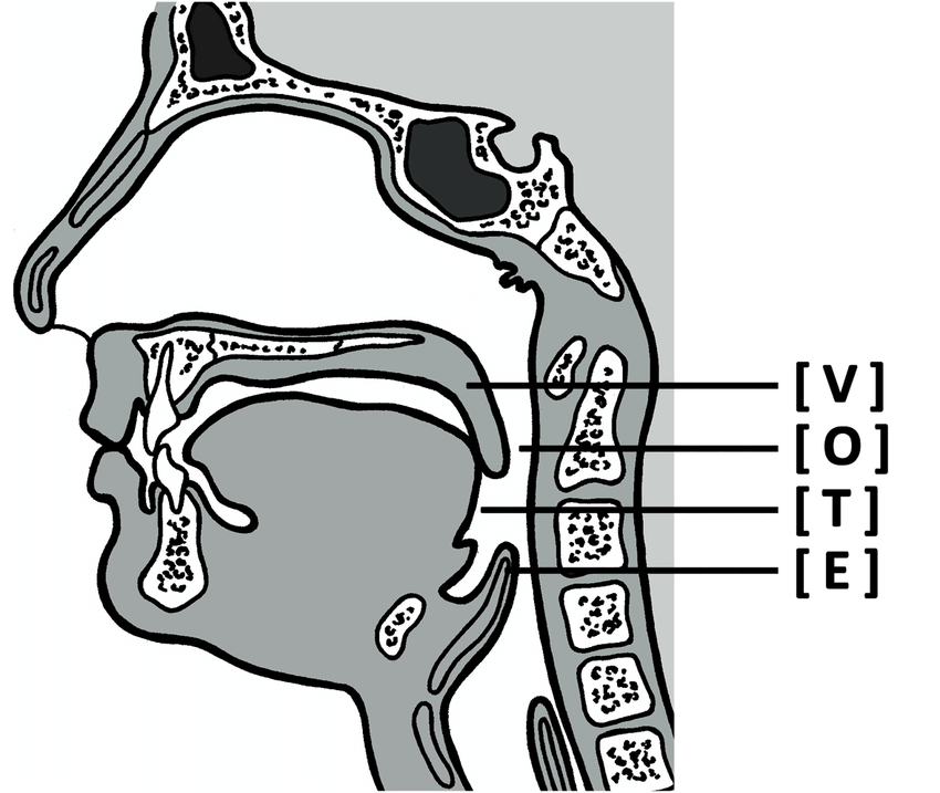 Corresponding positions of the VOTE classification in the.