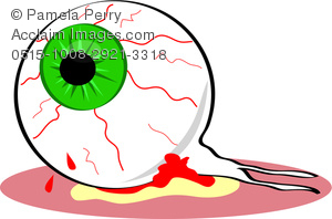 Clip Art Image of an Eyeball Popped Out and Bloodshot.