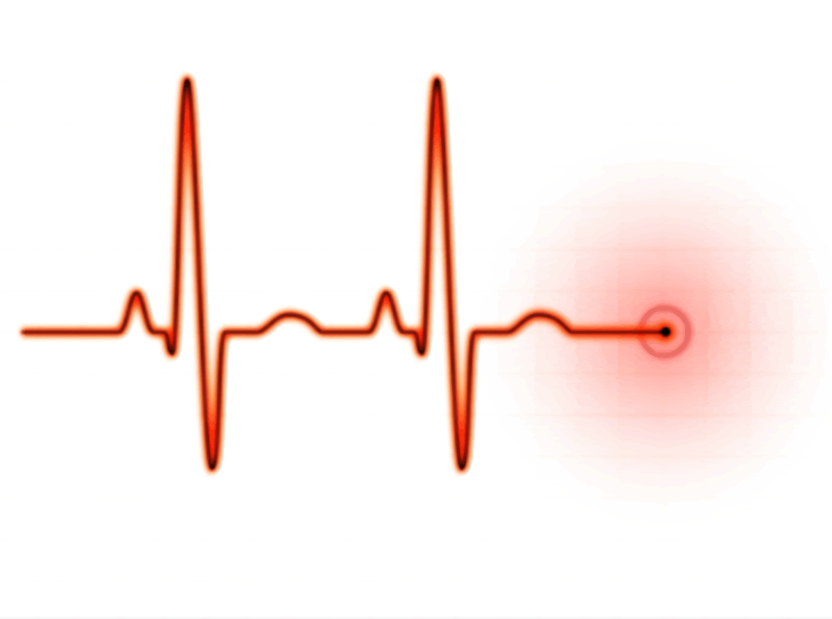 Ekg Strip Clipart.