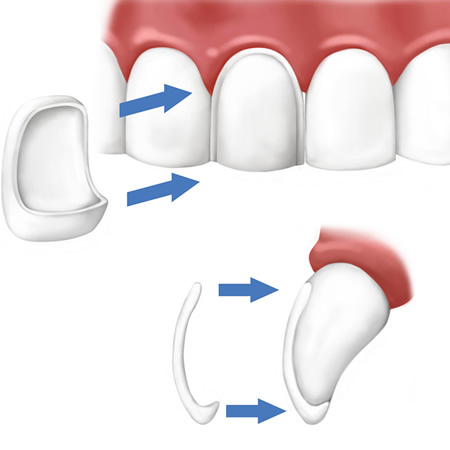 Identist Family Dental Care in Algodones Algodones mexico.