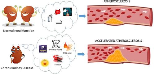 Atherosclerosis in Chronic Kidney Disease.