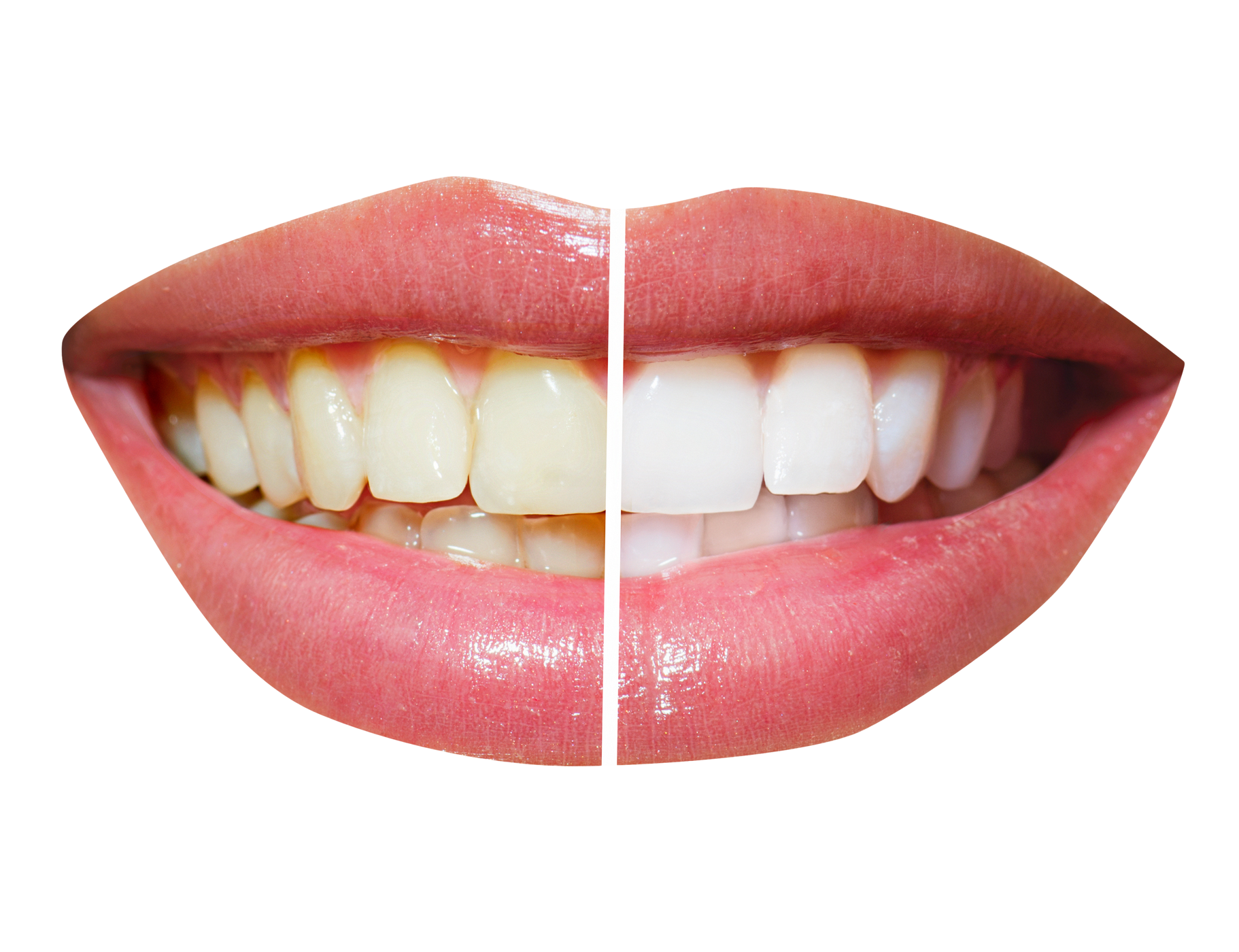 Teeth PNG File #46535.