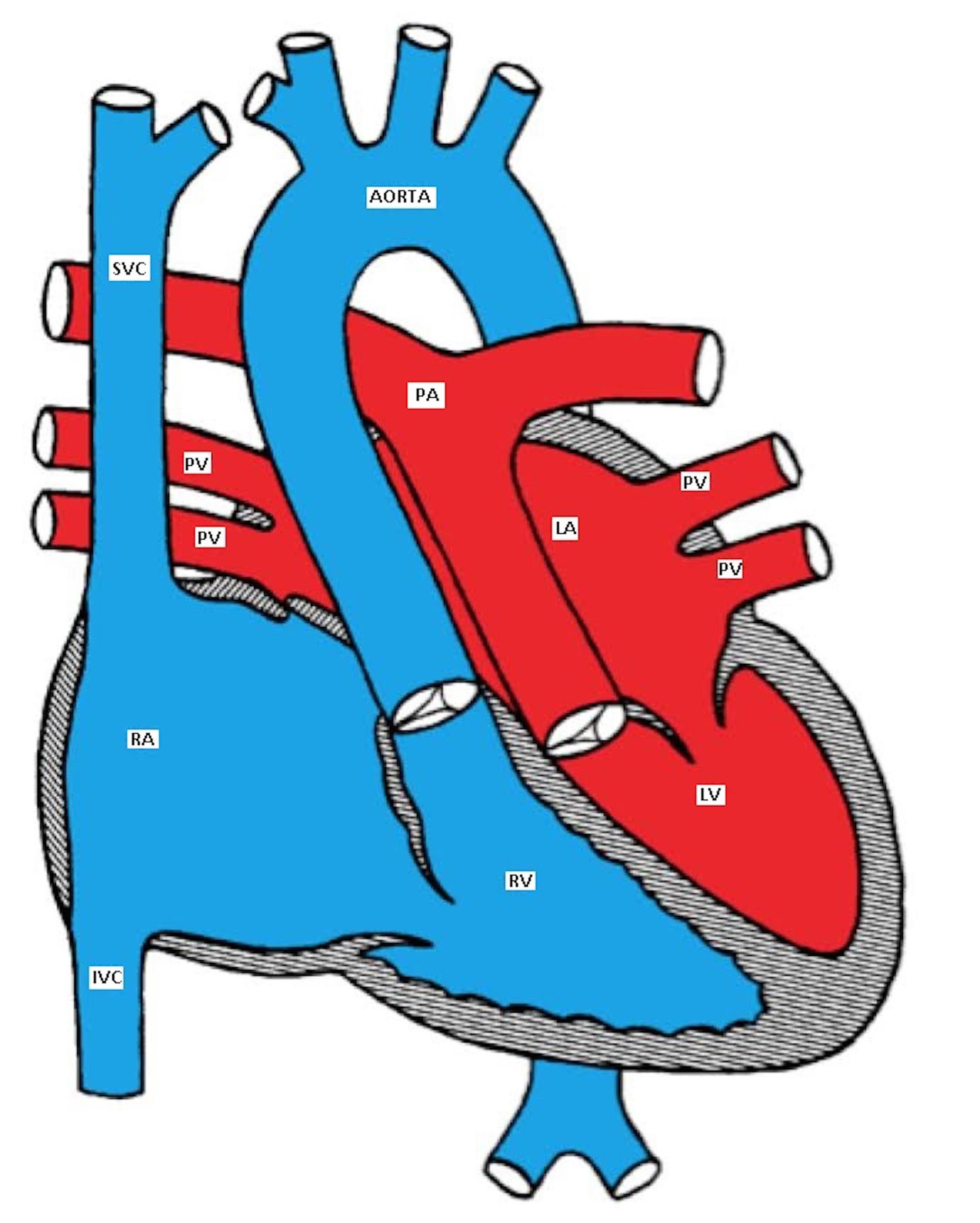 Cyanotic Cardiac Lesions.