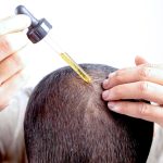 7 Minyak Esensial Untuk Rambut yang Bisa Atasi Ketombe dan Rontok