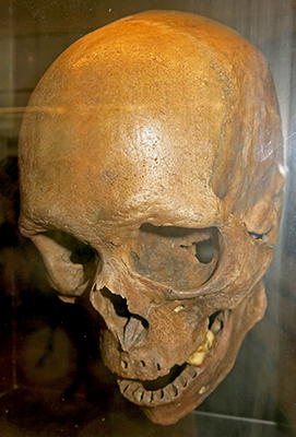 skull