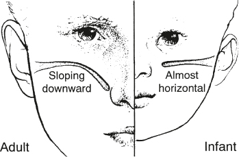 Auditory System and Related Disorders | Ento Key