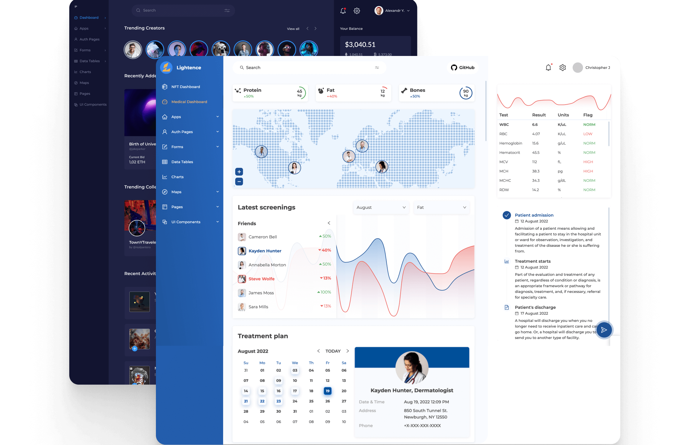 Lightence Admin Template