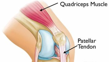 tubercle