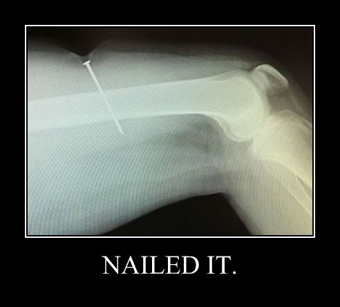 wtf funny Nailed It leg - 8362143744