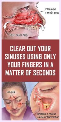 Here’s How to Clear Your Sinuses Quickly In Just Two Steps