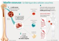 Le nouveau visage des greffes de moelle osseuse | Actualité | LeFigaro.fr - Santé