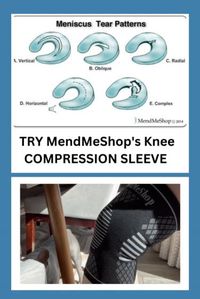 Discover effective ways to cope with meniscus tears, a common knee injury. Whether you're recovering from surgery or looking for non-surgical remedies, this pin offers valuable insights and tips for managing meniscus tears. Explore exercises, treatments, and lifestyle changes that can help you get back on your feet and back to doing what you love.

What is a Meniscus Tear?
 • A meniscus tear is a common knee injury that can cause pain, swelling, and limited mobility.
 • It often happens during sports, but can also result from everyday activities.

Surgical vs. Non-Surgical Options:
 • Treatment options for meniscus tears vary and may include surgery (meniscectomy or meniscus repair) or non-surgical approaches (physical therapy, rest, and anti-inflammatory medications).

RICE Protocol:
 • R