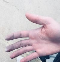 if your hands look like this go see a doctor. reynaud’s is not “aesthetic” the character i’m creating this board for just happens to have cyanosis. img source linked.

luka alien stage aes alnst