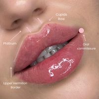 Gorgeous Lip Anatomy When positioned in the subdermal fat or muscular tissue, hyaluronic acid will act as a filler, shaping or plumping' the tissue. . . . #russianlip #russianlipslondon