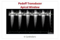 Helpful Tips to Mastering the Pedoff Probe!