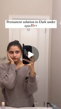 Shayana Prafull Upadhyay on Instagram: "Say bye to “Dark circles” permanently❗❗  If you are also the one who gets enough sleep but still faces the issue of having dark circles, then you must try this!  I sleep around 8-9 hours but still, I get these dark under-eye bags because my sleep cycle is really poor, I stay up till late at night (which is the main cause of dark circles)  But, yes this not only helps to get rid of dark under-eyes or dark circles but also hydrates your under-eye skin  #skincaretips #darkcirclestreatment #darkundereyes #darkcircles"