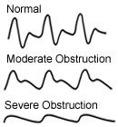 Waveform Samples. ABI.