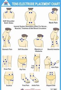 tens unit elctrode placement |