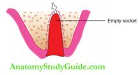 Traumatic Dental Injuries in Primary Dentition Notes - Anatomy Study Guide