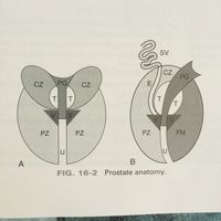 Prostate anatomy. Periurethral glands. Central zone. Transitional zone. Verumontanum. Peripheral zone.