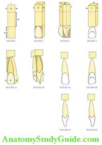 Carving Of The Permanent Incisors The steps in carving of the permanent maxillary central incisor will be described in detail. The permanent maxillary lateral incisor and permanent mandibular incisors can be carved following the same steps but with variation in features. Note : Measurements to be noted down from the respective chapters Carving Of The […]