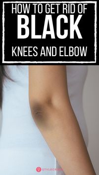 14 Home Remedies To Get Rid Of Black Knees And Elbow: Does having dark knee caps and elbows make you conscious and leave you feeling uncertain about your appearance? You miss wearing your favorite clothes, don’t you? Don’t worry, you have come to the right place looking for a solution. #SkinCare #SkinCareTips #Beauty #BeautyTips