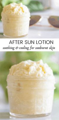 This soothing after sun lotion is exactly what you need for your summer vacation! If you get a little too much sun, you are going to need this after sun lotion. It is made with moisturizing coconut oil, aloe vera gel, and essential oils that will leave your skin soft and cool. #aftersunlotion #sunburnrelief #homemadelotion #diylotion #sunburncream