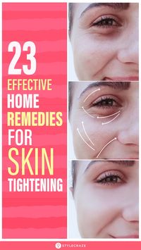 23 Effective Home Remedies For Skin Tightening: As we grow old, our skin starts to show signs of aging. It starts losing its natural elasticity, which leads to sagging. Sagging of skin is a natural process and is irreversible, but it can be reduced and delayed. Let us take a look at the home remedies that you can use to firm up and tighten your skin. #SkinCare #SkinCareTips #SkinTightening