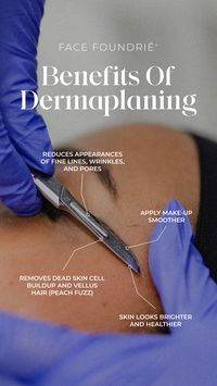 Benefits of Dermaplaning!  -Reduces appearances of fine lines, wrinkles, and pores Apply Make-up smoother Removes dead skin cells buildup and vellus hair (peach fuzz) Skin looks brighter and healthier