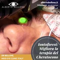 Iontoforesi: Migliora la terapia del Cheratocono - Dr. Alberto Bellone - Oculista Torino e Milano 👁️ Vantaggi della procedura di iontoforesi Drastica riduzione nei tempi di imbibizione (da 30 minuti a 5 minuti) Tecnica EPI-ON Concentrazione di riboflavina nello stroma più elevata rispetto all’imbibizione TE standard, più omogenea e riproducibile rispetto alla tecnica EPI-OFF👀 --- Visita: http://albertobellone.it/iontoforesi --- @alberto.bellone.oculista --- #cheratocono #malattia