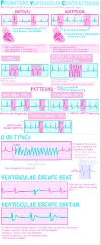 EKGs