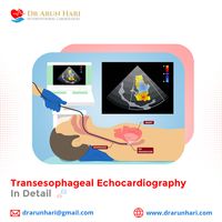 Transesophageal Echocardiography or Echocardiogram Transesophageal (TEE) is a special type of an echocardiogram that looks at the heart from inside the esophagus rather than from outside the chest. What more? Read our article to know more. You can approach Dr Arun Hari through his website https://drarunhari.com/book-appointment/