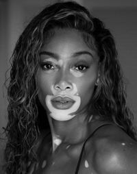 Winnie Harlow - November 30th, 2023