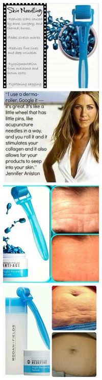 Hottest trend in skincare - Skin Needling!  Rodan + Fields Amp Roller jenifermccabe.myrandf.com