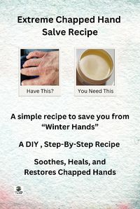 If you get those nasty, red, swollen, scaly, cracked, and bleeding "winter hands", then this recipe is for you. It is easy to make uses normal, natural ingredients and you can make it at home. Try the Extreme Chapped Hand Salve Recipe and get some relief.