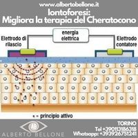 Iontoforesi: Migliora la terapia del Cheratocono﻿ - Dr. Alberto Bellone | Roma Milano e Torino Con la iontoforesi la tecnica di CXL raggiunge il top in quanto unisce i benefici della tecnica transepiteliale (assenza di haze, infezioni, dolore, nessuna riduzione del visus nel periodo post-intervento, non è necessaria una sala operatoria) ai vantaggi della tecnica standard EPI-OFF (maggiore penetrazione stromale). Visita: http://albertobellone.it/iontoforesi/ - #cheratocono #malattia #noninvas