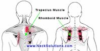 Pain Between Shoulder Blades - Causes & Treatments