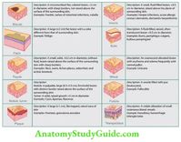 Description of Primary Skin Lesions Question 1. Define primary/secondary skin lesions and give examples. Answer: Read And Learn More: General Medicine Question And Answers Description of Secondary Skin Lesions Papulosquamous Disorders Psoriasis Question 2. Discuss the types and describe the various modalities of treatment of psoriasis including topical, systemic, drugs, and phototherapy. Answer: It is […]