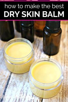 Do you suffer from dry, itchy skin on your face, body, arms, hands, legs or feet during winter? Our Soothing DIY Dry Skin Balm recipe is full of nourishing and hydrating ingredients that soothe dry skin! This homemade natural remedy works wonders as a moisturizer on extremely dry skin and includes essential oils. #dryskin #dryskinbalm #balms #balmrecipes #essentialoils #essentialoilrecipes #naturalremedies #winter #moisturizing #essentialoiluses #howto #salves #skincare #diybeauty #naturalbeauty Dry Skin Diy, Balm Recipe, Skin Care Routine For 20s, Extremely Dry Skin, Skin Balm, Diy Kosmetik, Perfectly Posh, Avon Products, Dry Skin Care