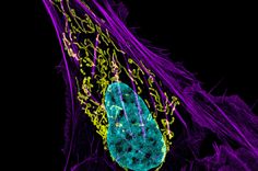 an animal cell is shown in purple and green