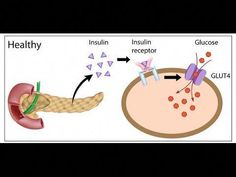 Insulin resistance video: https://www.youtube.com/watch?v=fRZduVxlP_UTo get your FREE 3-Meal Quick Start Guide and Newsletter go to:http://potatostrong.comSu... Mediterranean Men, Sugar Is Bad, Hunger Control, Insulin Sensitivity, Best Diet, Ways To Burn Fat, Hormone Health, Insulin Resistance, Health Articles