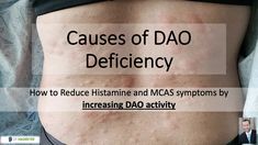 Dao Boosting Foods, Mcas Symptoms, Antihistamine Diet, Autonomic Dysfunction, Mast Cell Activation