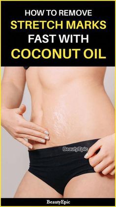 Strech Marks, Apply Coconut Oil, Coconut Oil Hair Mask, Stretch Mark Removal, Fall Makeup Looks, Baking Soda Shampoo, Moisturizer For Oily Skin, Coconut Oil Hair, Best Anti Aging